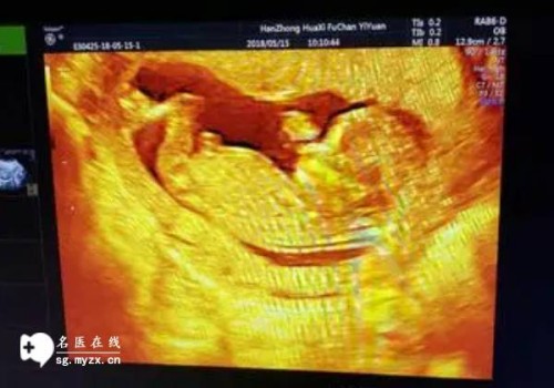 洛阳市妇幼保健院试管成功率一览，附河南省试管医院推荐_1